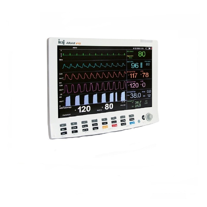 مانیتورینگ علائم حیاتی صاایران