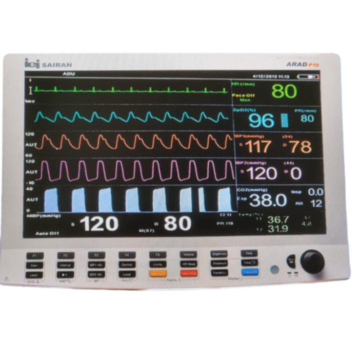 مانیتورینگ علائم حیاتی صاایران